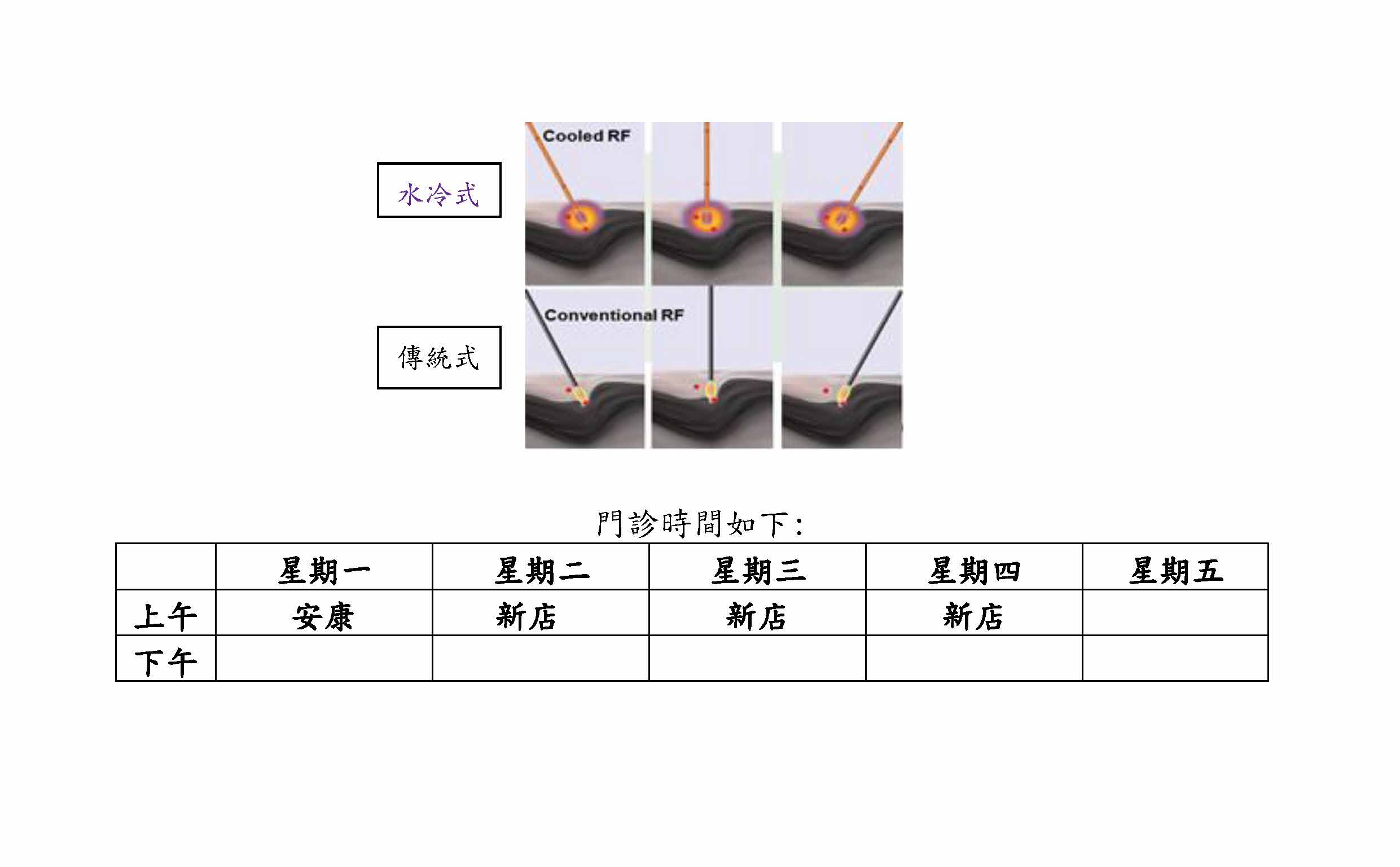 2019 02 14 水冷式高頻熱凝療法 免開刀 快速 安全並可產生更大 更完整的燒灼範圍 解決病患疼痛治療新選擇 優質服務 天主教耕莘醫療財團法人耕莘醫院